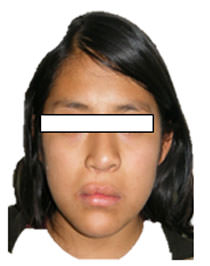 Fig. 15 Frente