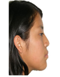 Fig. 16 Foto final perfil