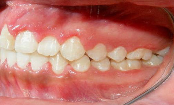 Fig.20 Lateral izquierda