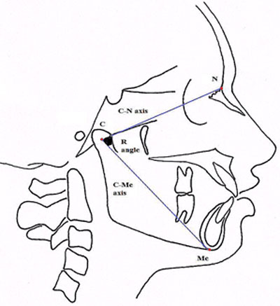 Figure 1 R angle
