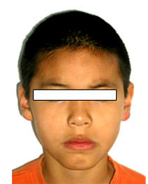 Fig. 1 Inicio de frente 	