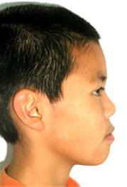 Fig. 2 Inicio de perfil