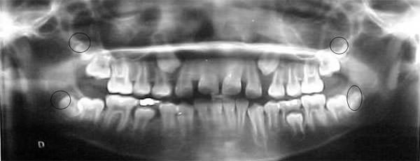 Fig. 4 Panorámica inicio