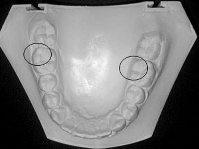 Fig. 9 Modelo de estudio inferior 