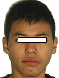 Fig. 16 Final de frente