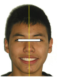 Fig. 19 Final facial