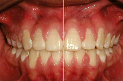 Fig. 20 Línea dental