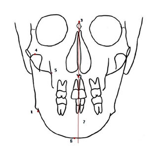 Fig.1 Landmarks identified