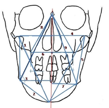 Fig.2 Measurements carried out