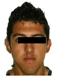Fig. 1 Frente