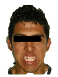 Fig. 2 Sonrisa