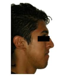 Fig. 3 Perfil