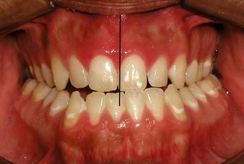 Fig. 4 Fotografía intraoral de frente