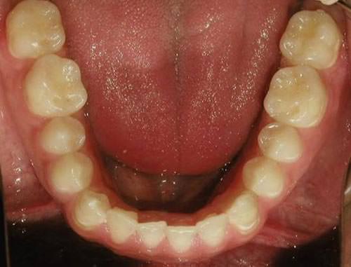 Fig. 8 Fotografía oclusal inferior