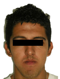 Fig. 11 Fotografía de frente