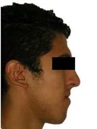Fig. 13 Fotografía de de perfil