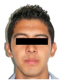 Fig. 21 Fotografía de frente