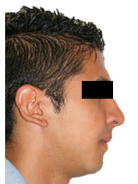 Fig. 23 Fotografía de de perfil