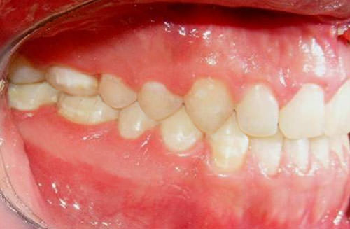 Fig. 25 Fotografía lateral derecha