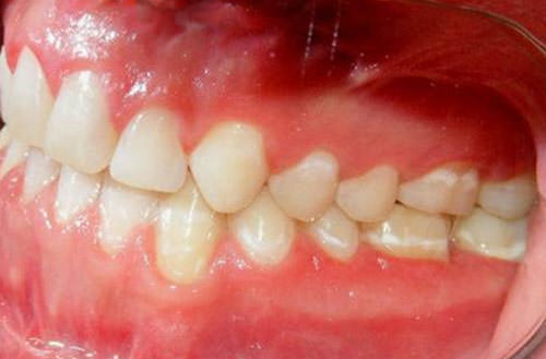 Fig. 26 Fotografía lateral izquierda