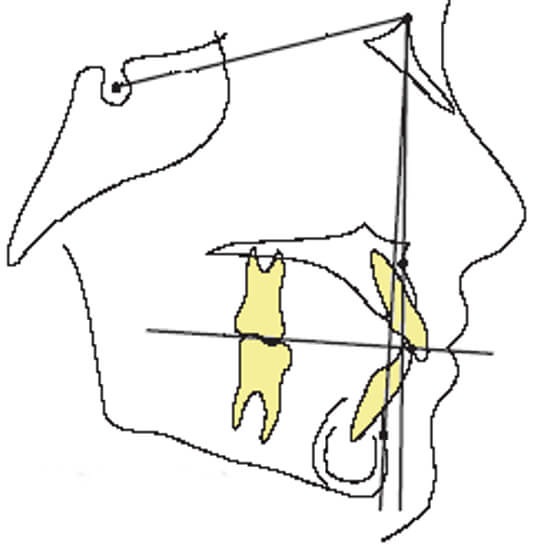 Imagen 9 Normal oclusal plano 1