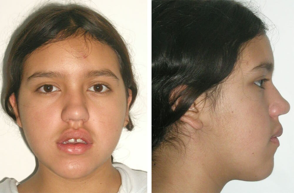 Fig. 1 y 2