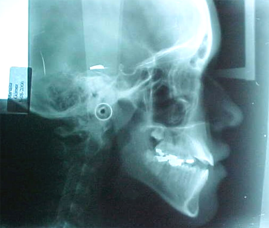 Fig. 6