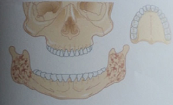 Figura 1