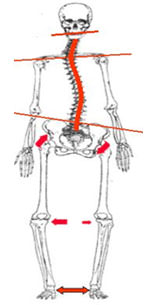 Fig.10 Síndrome postural ascendente Tomada Conferencia impartida en las 7ª Jornadas de Encuentro Pediatría Odontopediatría, España 2.006 