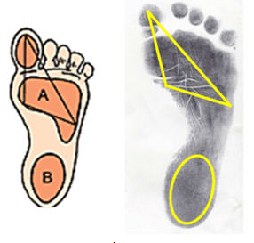 Fig. 12 Apoyo normal. (Fuente propia)