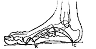 Fig. 13 Zonas de apoyo normal. Tomada Moreno de la Fuente J. Podología general y Biomecánica, Edit. MASSON 2.003,1ª edición.