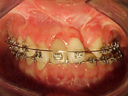 Figura 29 Fotografía de seguimiento intraoral de frente.