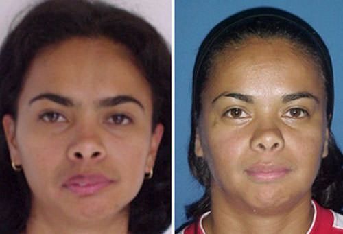 Figuras 30 y 31