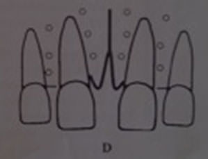 Figura 11