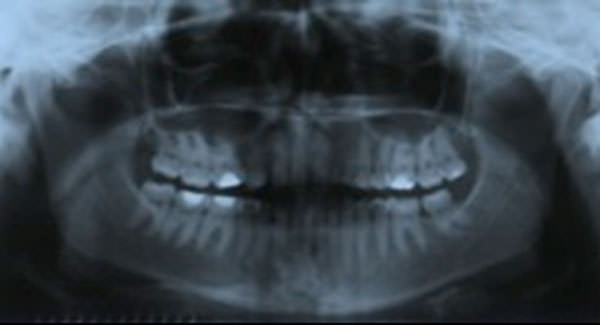 Figura 24