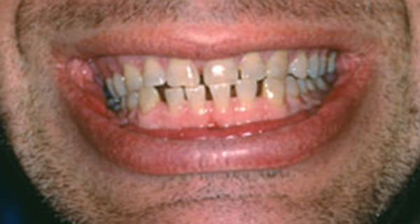 Figura 30