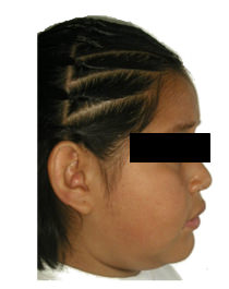 Figura 2 Paciente de perfil