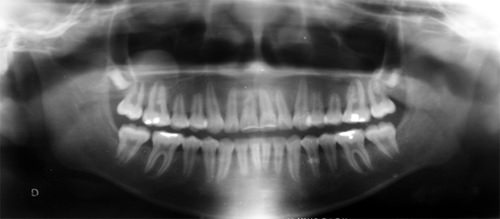 Figura 25 Radiografía panorámica
