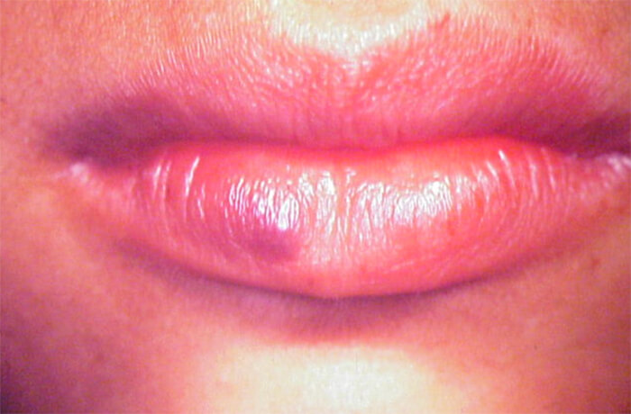 Foto Nº 1