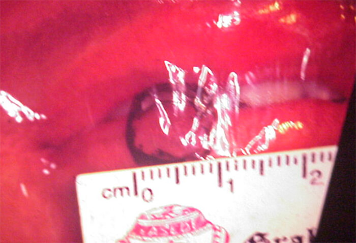 Foto Nº 4