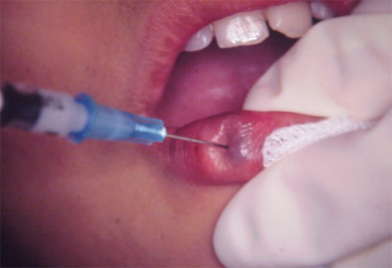 Foto Nº 6