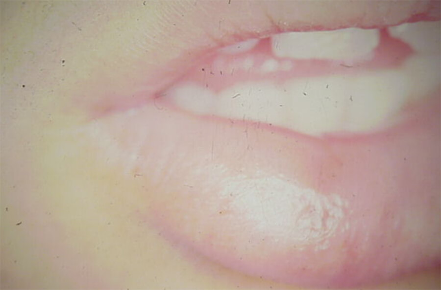 Foto Nº 7a
