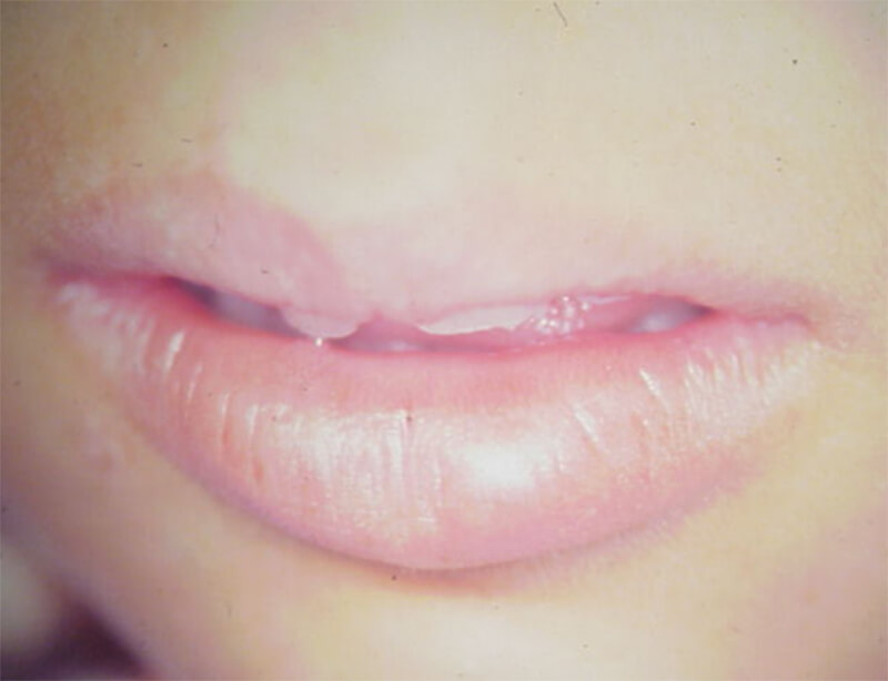 Foto Nº 7b