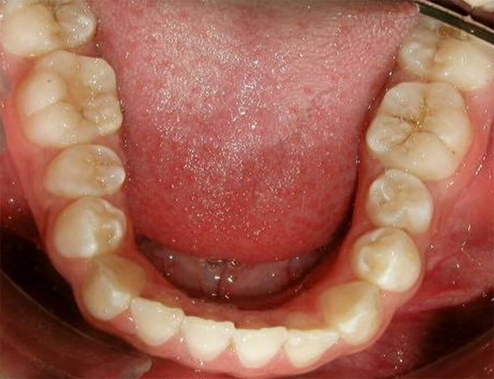Foto 8