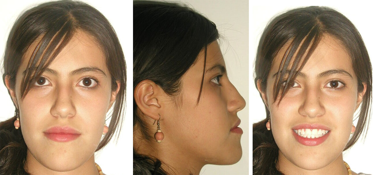 Foto 11. Frente / Foto 12. Perfil / Foto 13