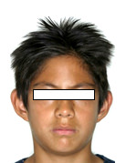 Figura 1 Extaoral de frente