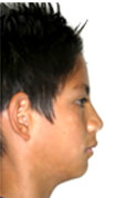 Figura 3 Perfil