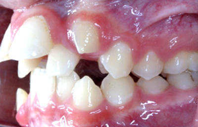 Fig 6 Lateral izquierda
