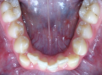 Fig 8 Foto Oclusal Inferior