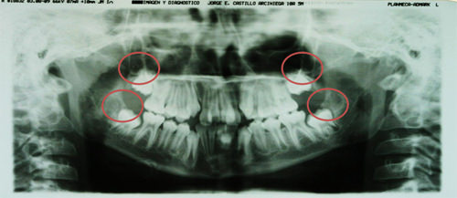 Fig 10 Radiografía Panorámica